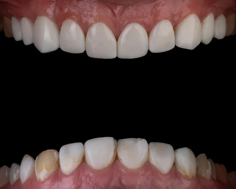 Soñar con perder los dientes: un símbolo entre imagen y cambio